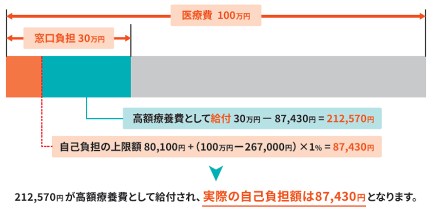 【例】70歳以上・年収約370万円～770万円の場合（3割負担）100万円の医療費で、窓口の負担（3割）が30万円かかる場合の図